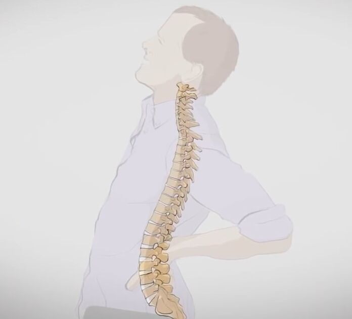 Back pain in the lumbar region. 