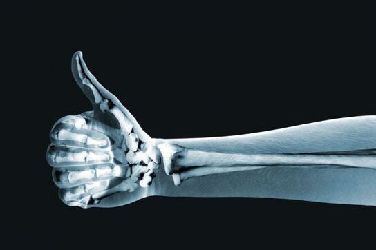 X-ray to diagnose pain in the finger joints. 