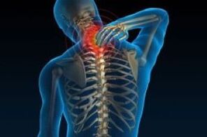 Cervical osteochondrosis leads to neck pain