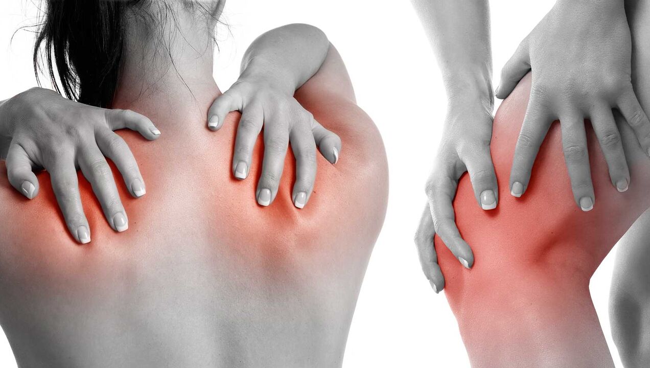 Joint pain due to arthritis.